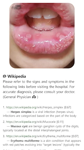 Download Model Dermatol Terbaru – Cek Penyakit Kulit Gratis description image 15