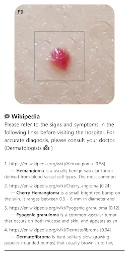 Download Model Dermatol Terbaru – Cek Penyakit Kulit Gratis description image 5
